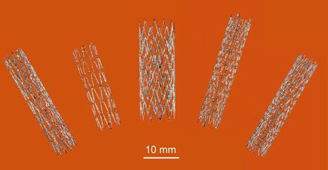 镍钛合金自膨胀血管支架3D打印研发取得新进展